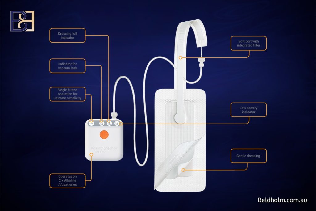PICO negative pressure dressing