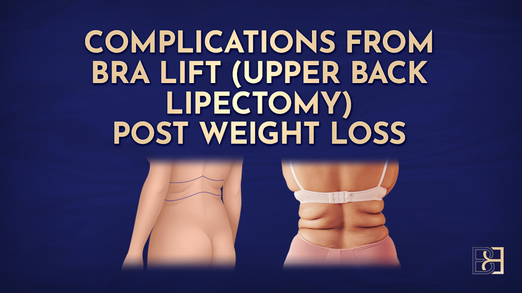 Complications from Bra lift (Upper Back lipectomy) post weight loss