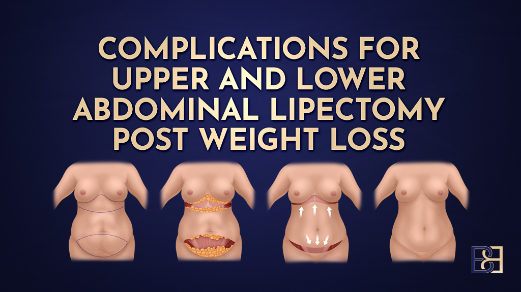 Complications for Upper and Lower Abdominal Lipectomy Post Weight Loss