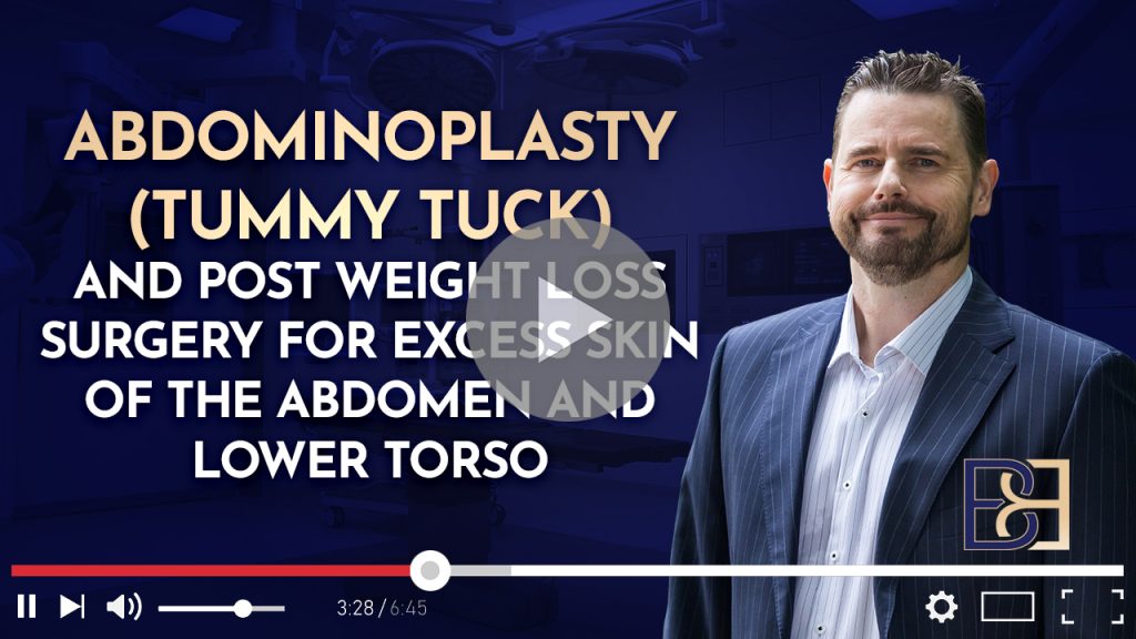 Excess Skin After Weight Loss – Surgical Options for the Abdomen and Lower Torso 6 Why Skin Pattern Matters After Massive Weight Loss