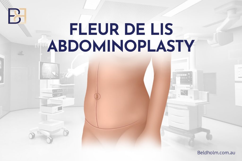 Excess Skin After Weight Loss – Surgical Options for the Abdomen and Lower Torso 5 Fleur de lis abdominoplasty for horizontal and vertical excess