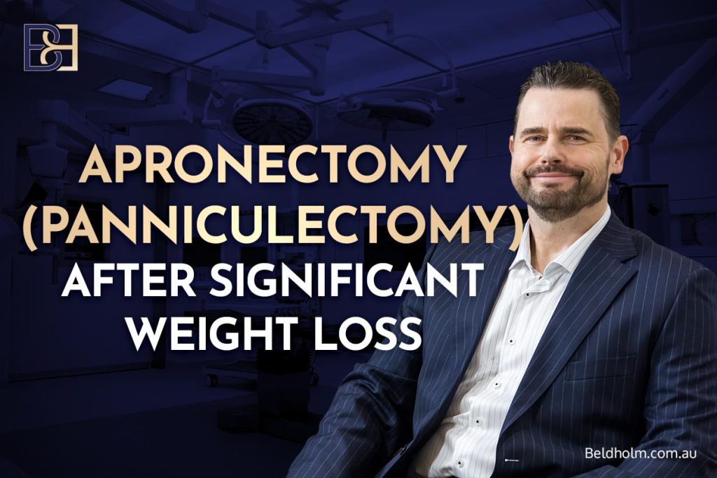 Apronectomy (Panniculectomy) After Significant Weight Loss