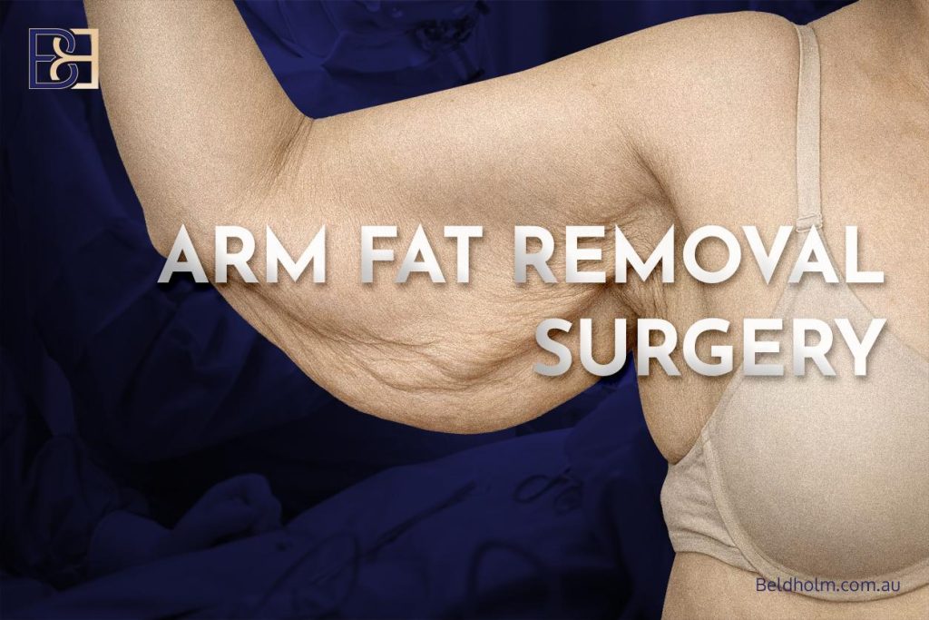 Arm Fat Removal Surgery 1 Arm Fat Removal Surgery
