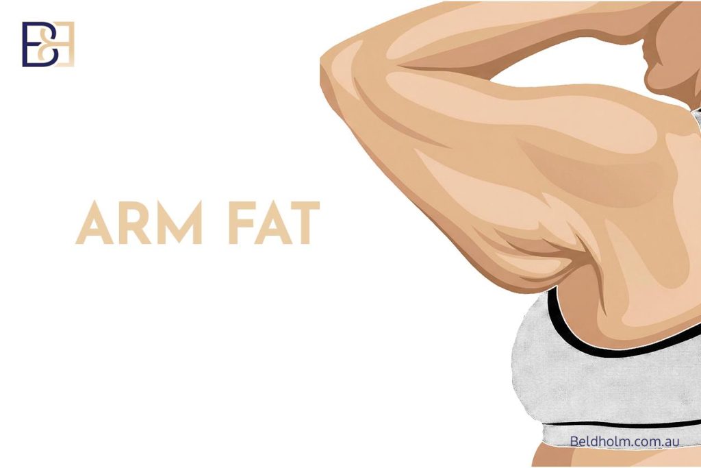 Arm Fat Removal Surgery 3 Brachioplasty - Arm Fat