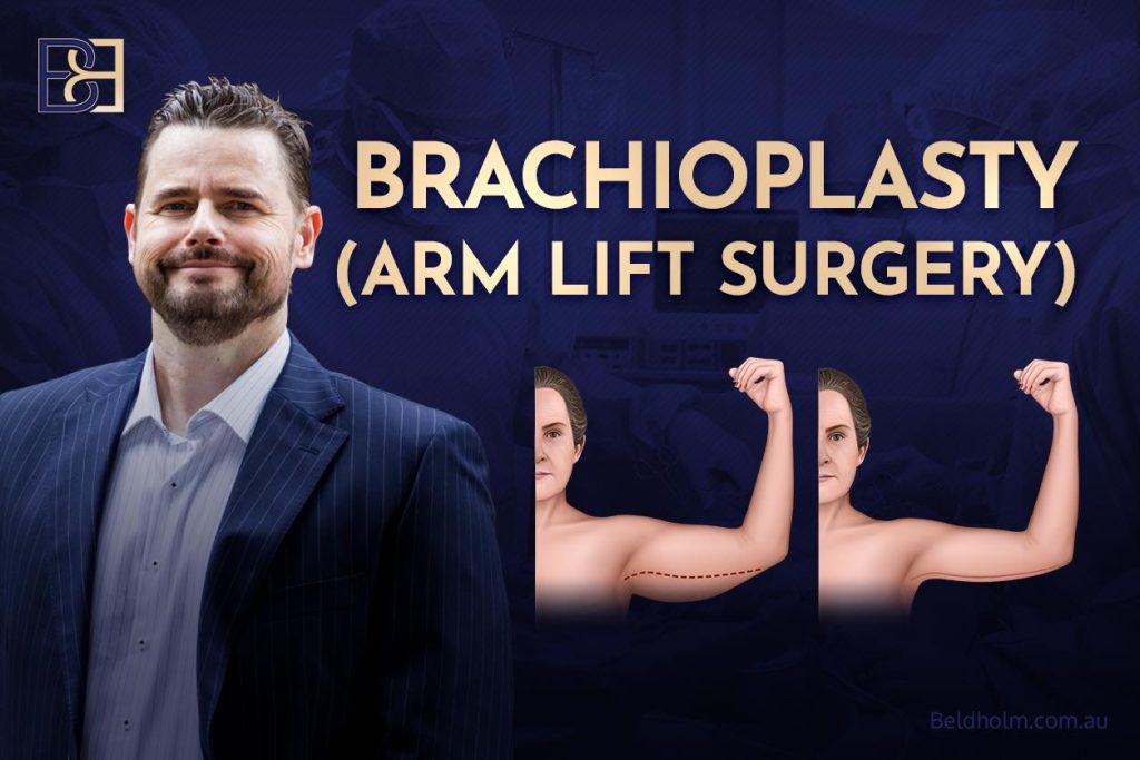 Brachioplasty (Arm Lift Surgery) 1 Brachioplasty (Arm Lift Surgery)