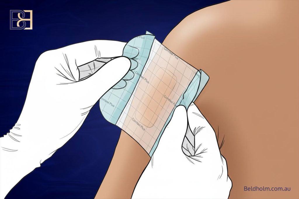 Brachioplasty (Arm Lift Surgery) 10 Comfeel Dressing