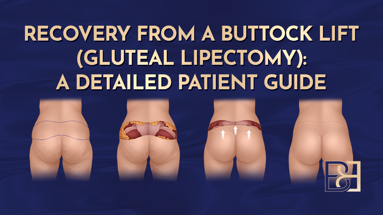 Recovery from a Buttock Lift (Gluteal Lipectomy): A Detailed Patient Guide