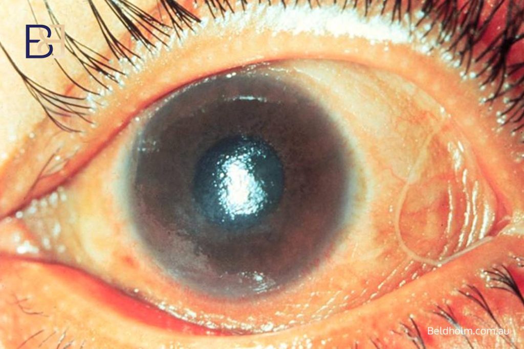 Broader eye effects