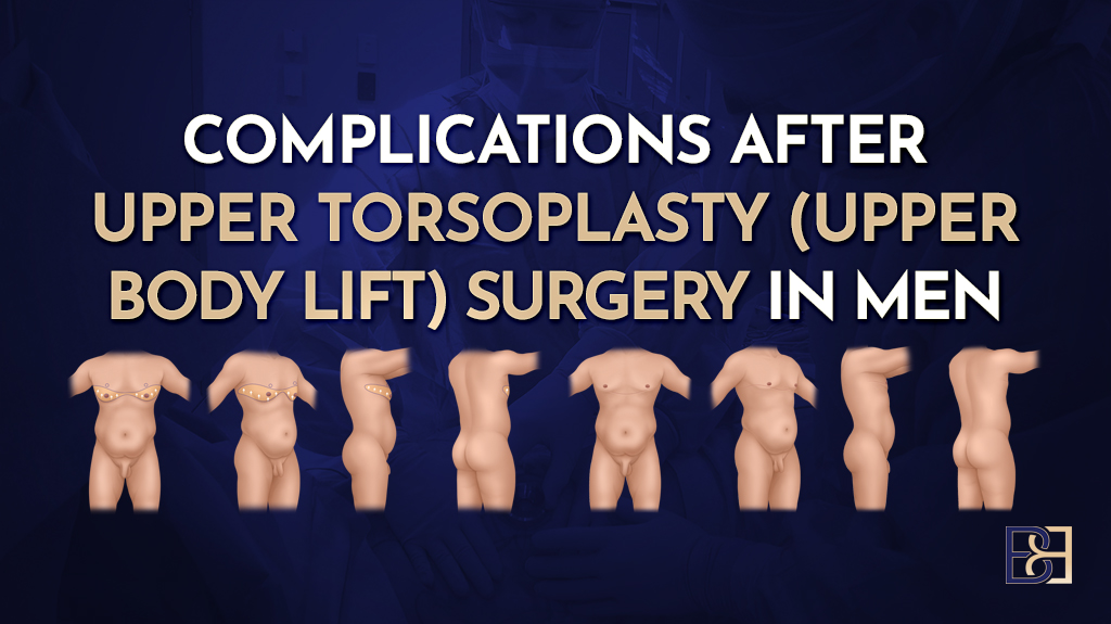Complications After Upper Torsoplasty (upper body lift) Surgery in Men
