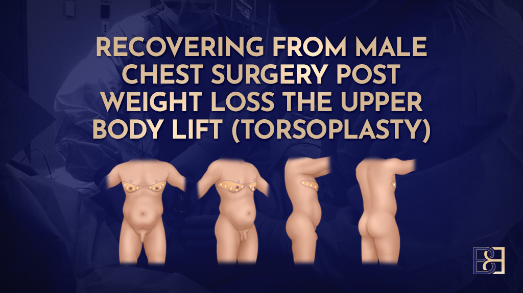 Upper Body Lift (Torsoplasty) Recovery – Focused Guide by Dr Bernard Beldholm