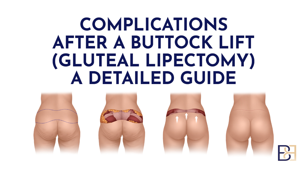 Complications After a Buttock Lift (Gluteal Lipectomy): A Detailed Guide