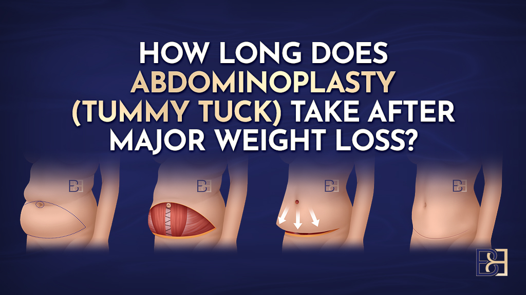 How Long Does Abdominoplasty (tummy tuck) Take After Major Weight Loss? A Detailed Surgical Timeline