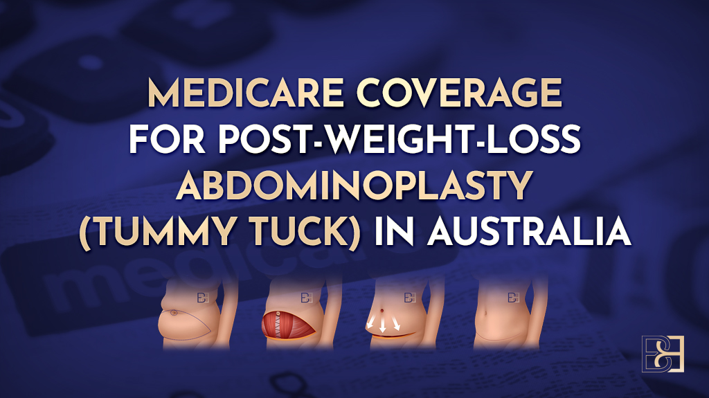 Medicare Coverage for Post Weight Loss Abdominoplasty (Tummy Tuck) in Australia