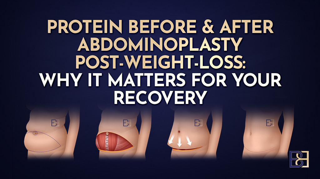 Protein Before and After Abdominoplasty (Tummy Tuck): Why It Matters for Post-Weight-Loss Patients