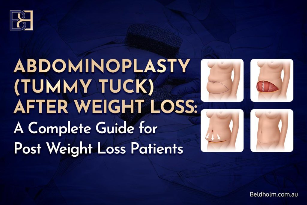Abdominoplasty (Tummy Tuck) After Weight Loss: A Complete Guide for Post Weight Loss Patients 1 Abdominoplasty (Tummy Tuck) After Weight Loss: A Complete Guide for Post Weight Loss Patients