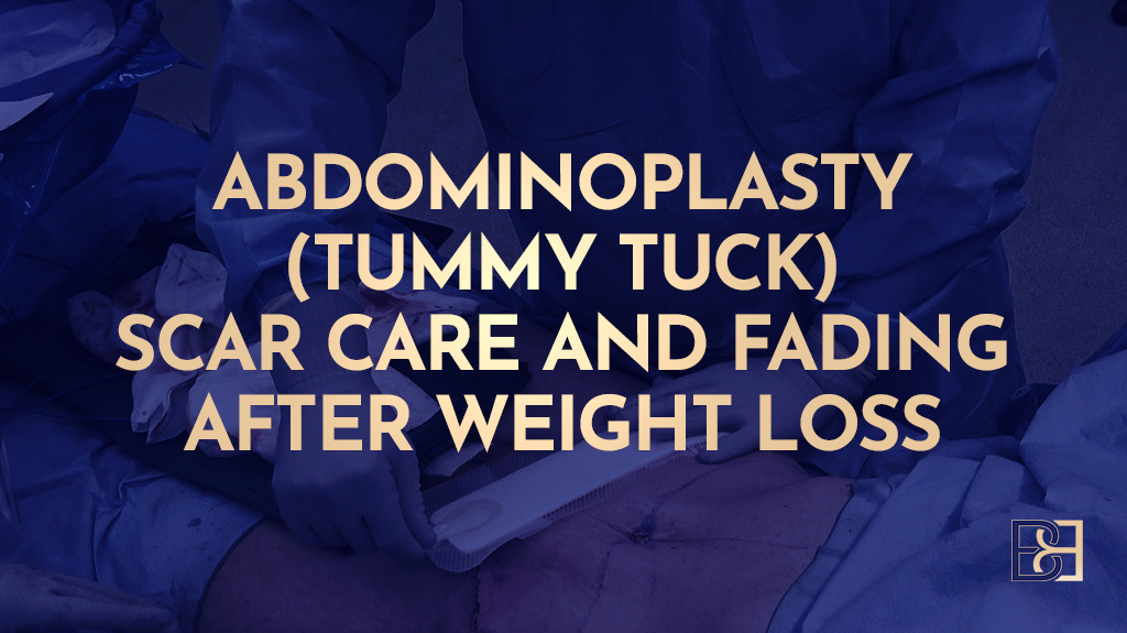 Abdominoplasty (Tummy Tuck) Scar Care and Fading After Weight Loss