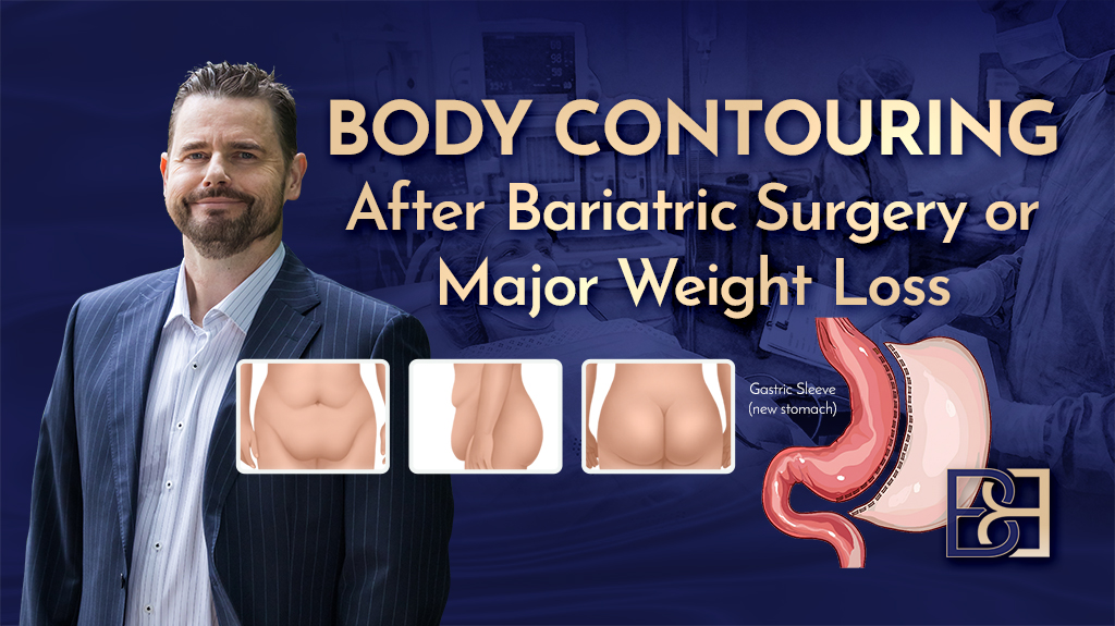 Body Contouring Surgery After Weight Loss