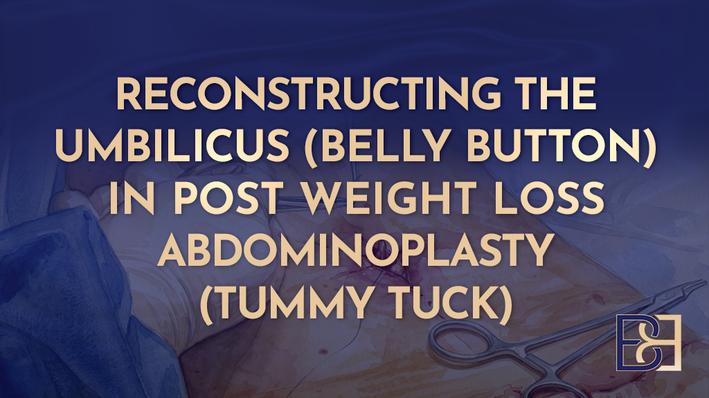 Reconstructing the Umbilicus (Belly Button) in Post Weight Loss Abdominoplasty (Tummy Tuck)