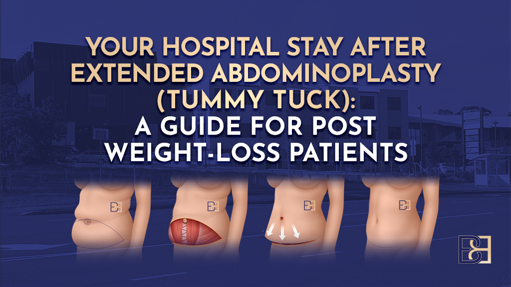 Your Hospital Stay After Extended Abdominoplasty (Tummy Tuck): A Guide for Post Weight Loss Patients