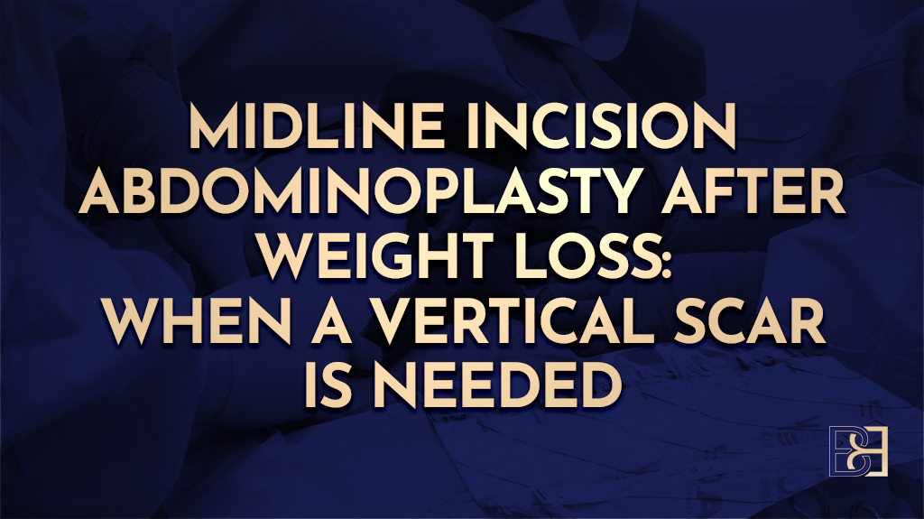 Vertical Incision Abdominoplasty (Tummy Tuck) After Weight Loss: When a Vertical Scar Is Needed
