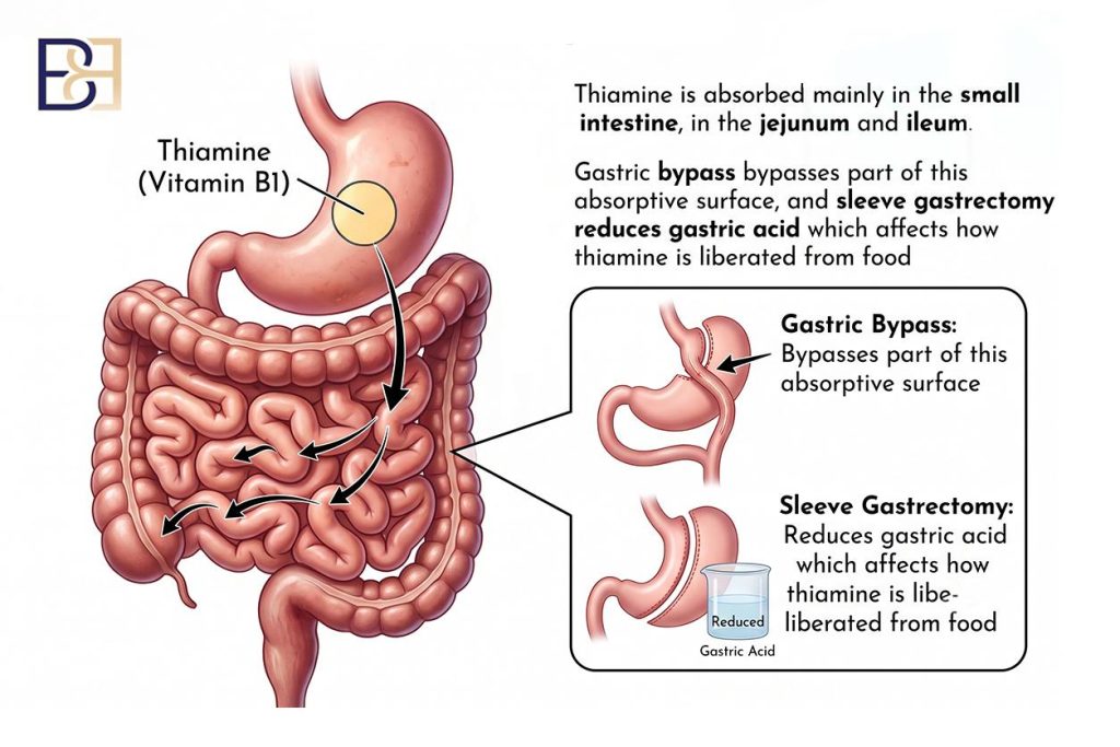 Malabsorption