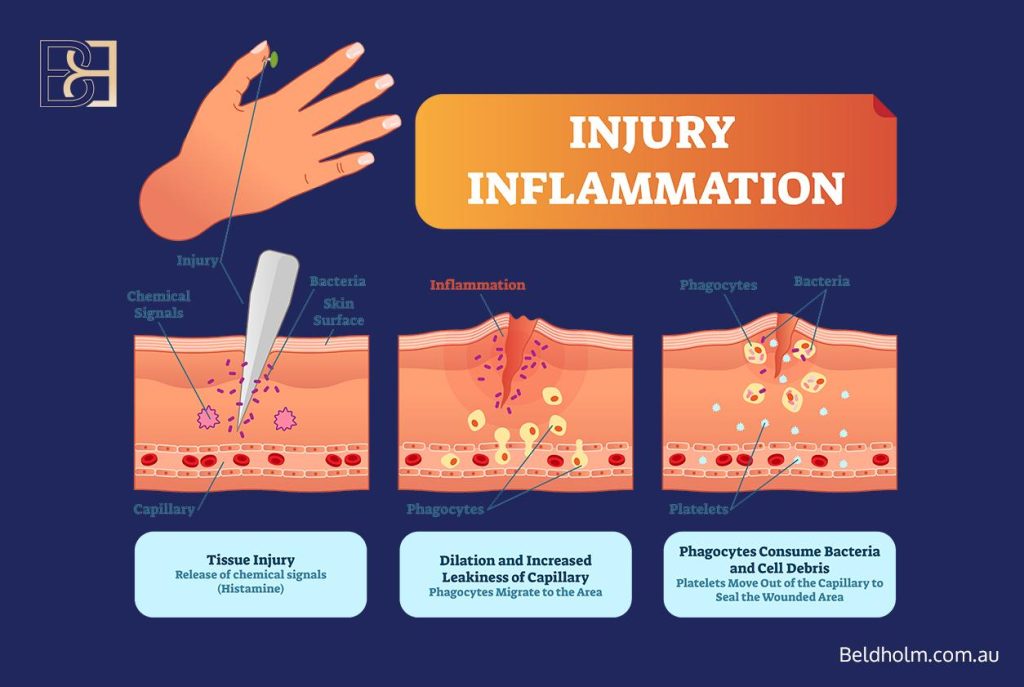 The three phases of wound healing and where zinc fits