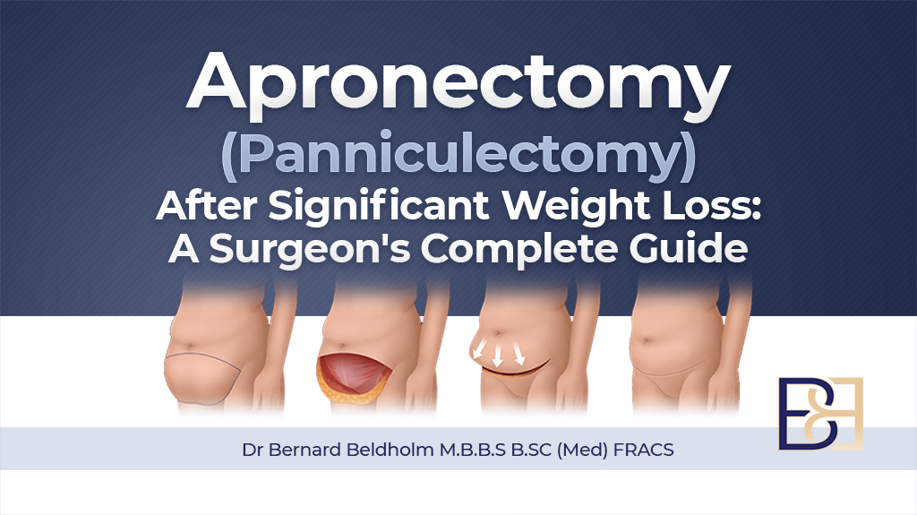 Apronectomy (Panniculectomy) After Significant Weight Loss: A Surgeon’s Complete Guide