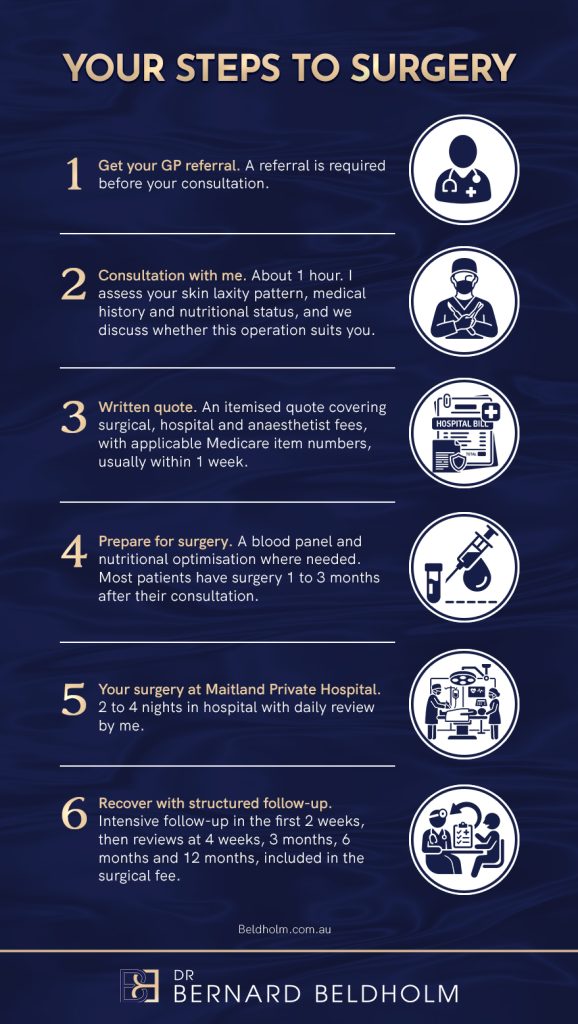 Belt Lipectomy - Steps to Surgery