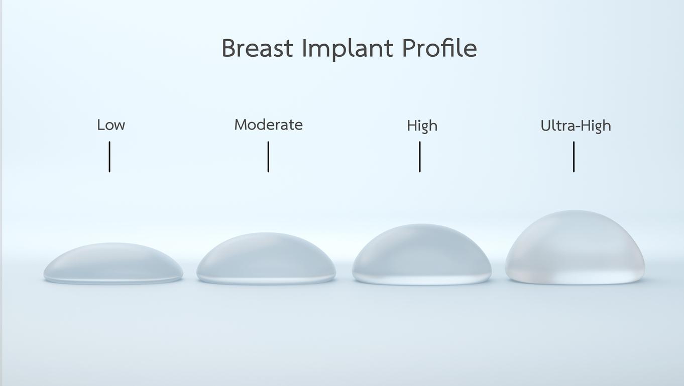 Breast Implant Profile - Dr Bernard Beldholm