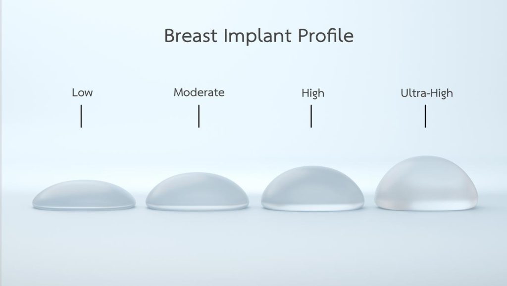 Breast Implant Profile - Dr Bernard Beldholm