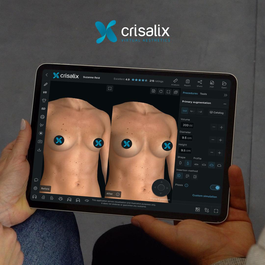 Crisalix - Dr Bernard Beldholm