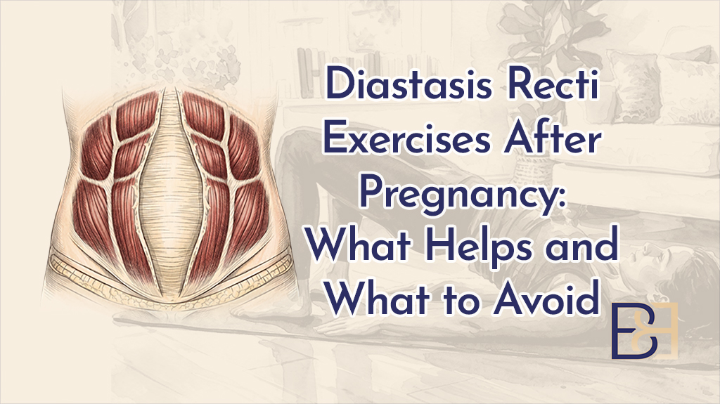 Diastasis Recti Exercises After Pregnancy What Helps and What to Avoid-featured image