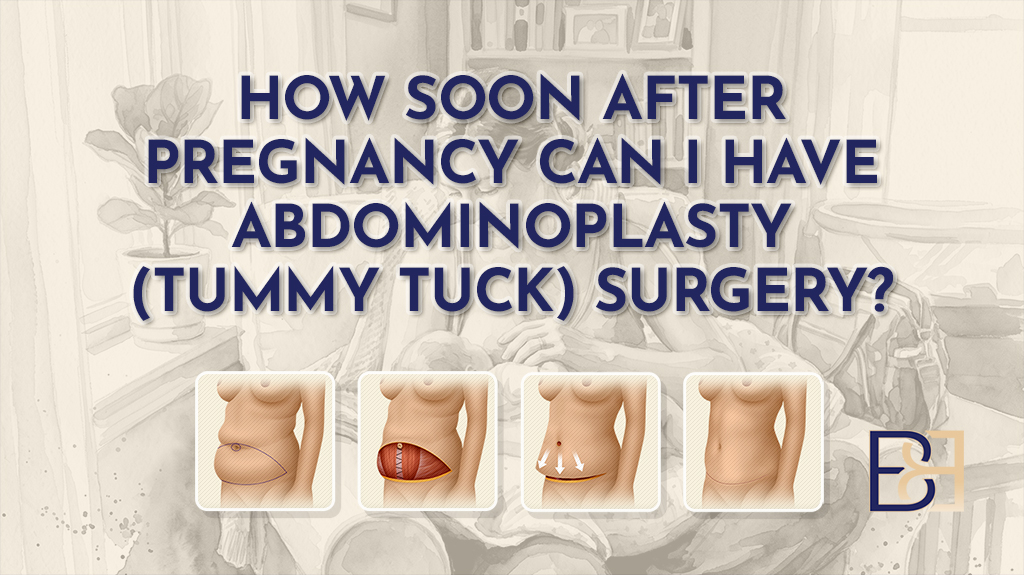How Soon After Pregnancy Can I Have Abdominoplasty-featured image