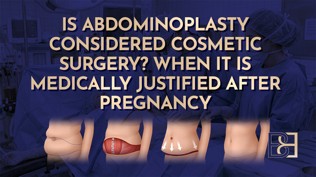 Is Abdominoplasty Considered Cosmetic Surgery-featured image