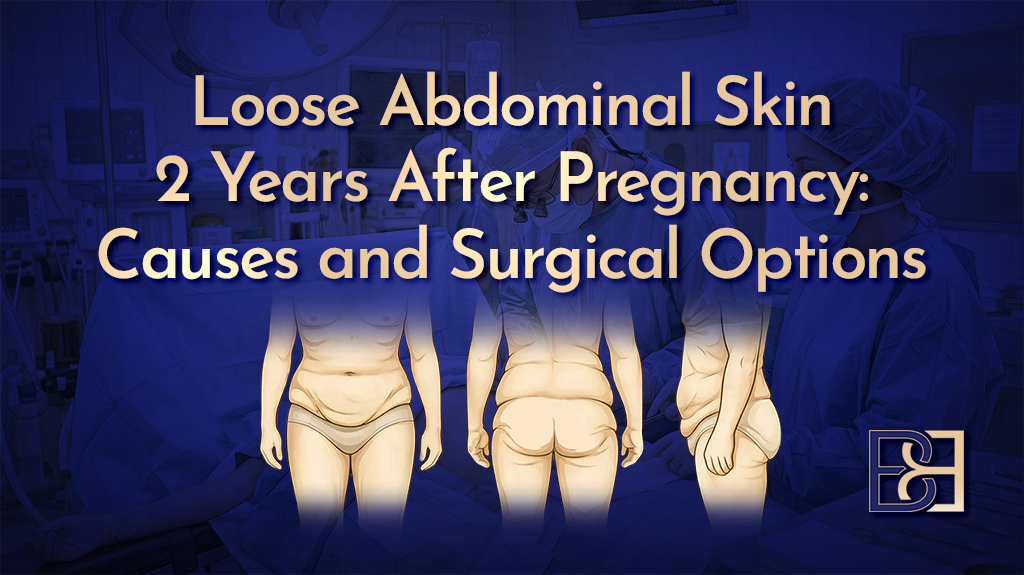 Loose Abdominal Skin 2 Years After Pregnancy-featured image