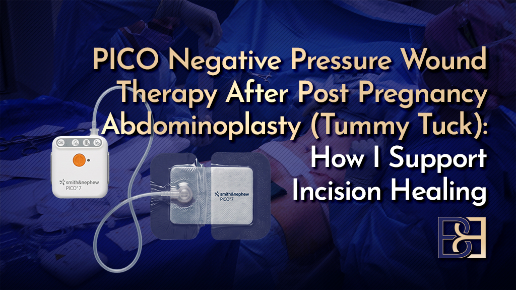 PICO Negative Pressure Wound Therapy After Post Pregnancy Abdominoplasty How I Support Incision Healing-featured image