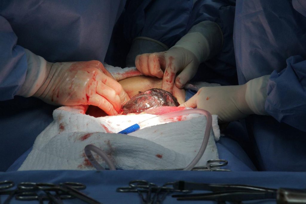 Two different operations, not the same surgery