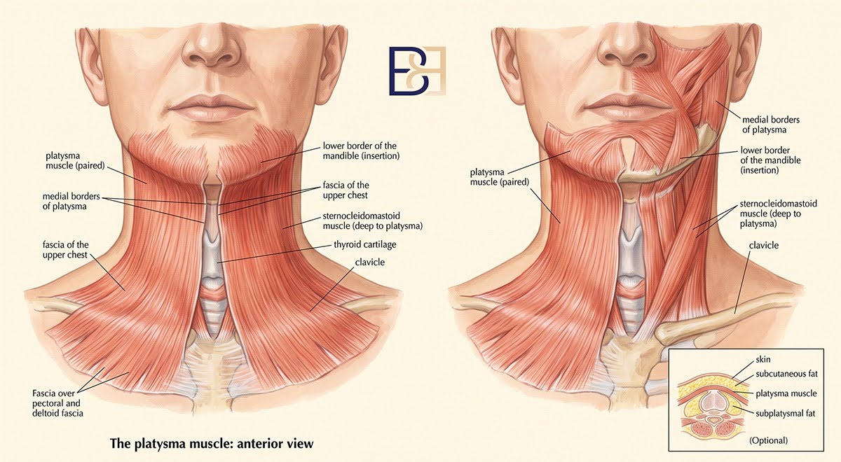 Deep Neck Lift (Cervicoplasty) in Newcastle NSW 2 What a deep neck lift (cervicoplasty) is suited to