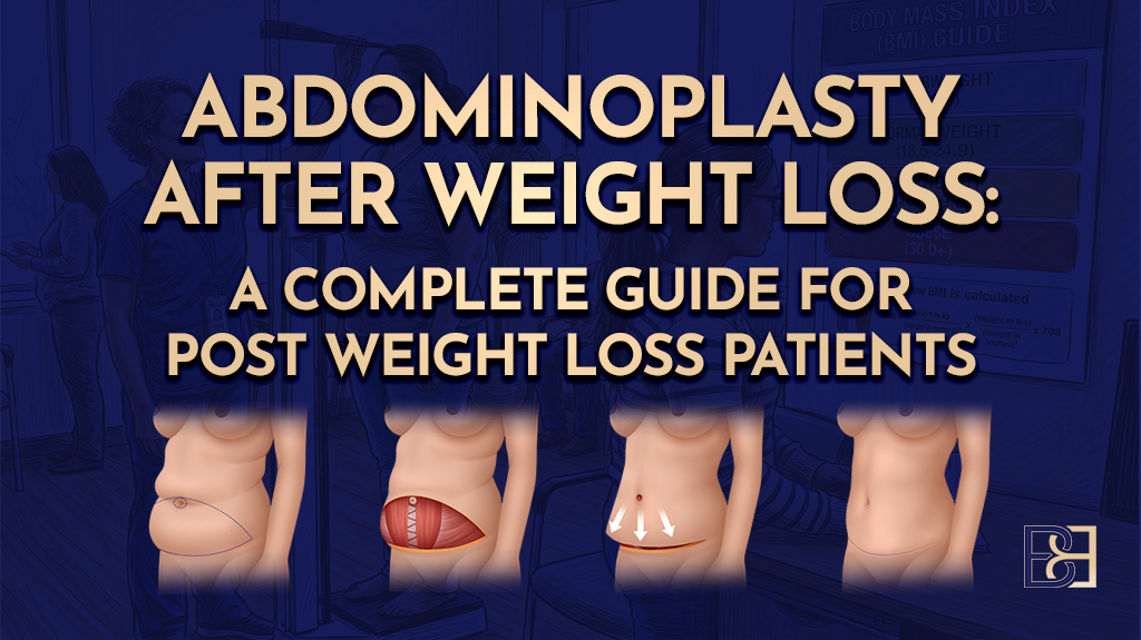Abdominoplasty After Weight Loss A Complete Guide for Post Weight Loss Patients-featured image