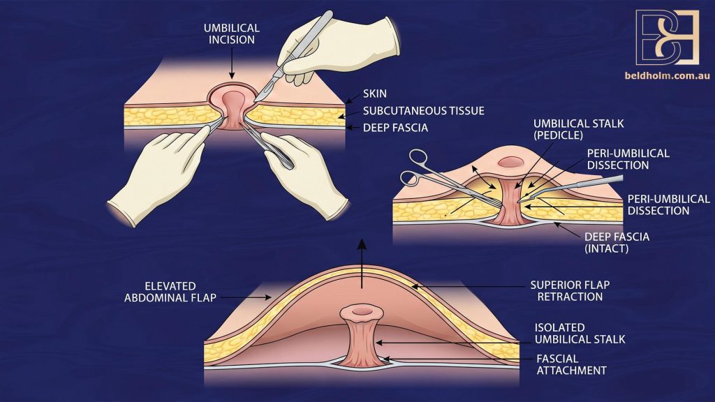 Hernias are repaired and muscle separation treated where present