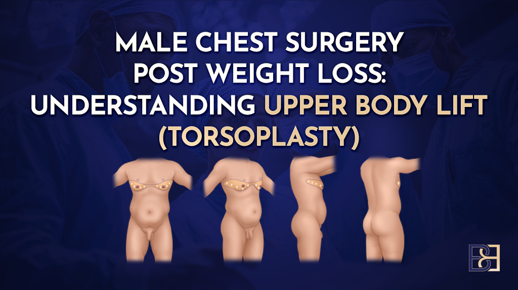 Male Chest Surgery Post Weight Loss Understanding Upper Body Lift-featured image