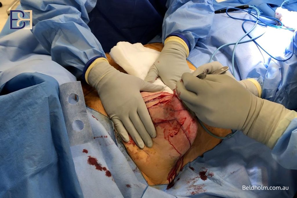Why this is treated as a more complex operation