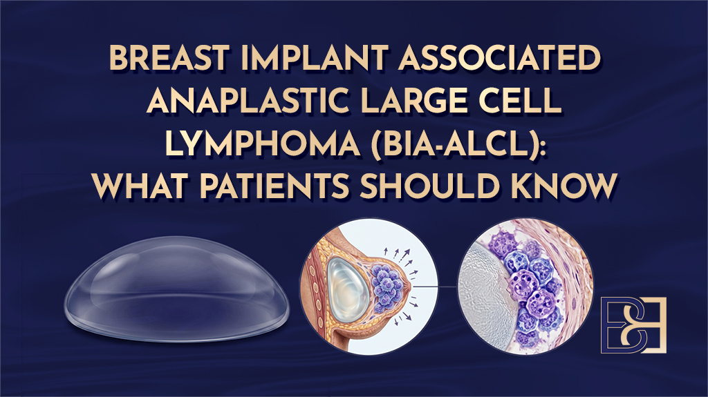 Breast Implant Associated Anaplastic Large Cell Lymphoma (BIA-ALCL)-featured image