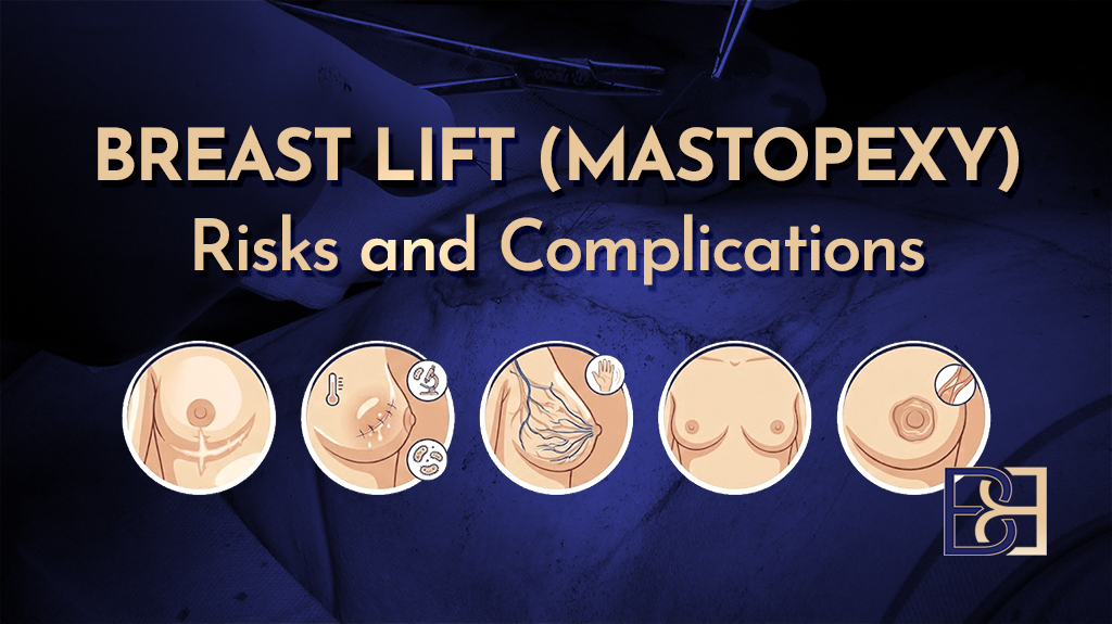 Breast Lift (Mastopexy) Risks and Complications - Featured Image