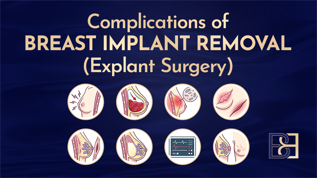 Complications of Breast Implant Removal (Explant Surgery)
