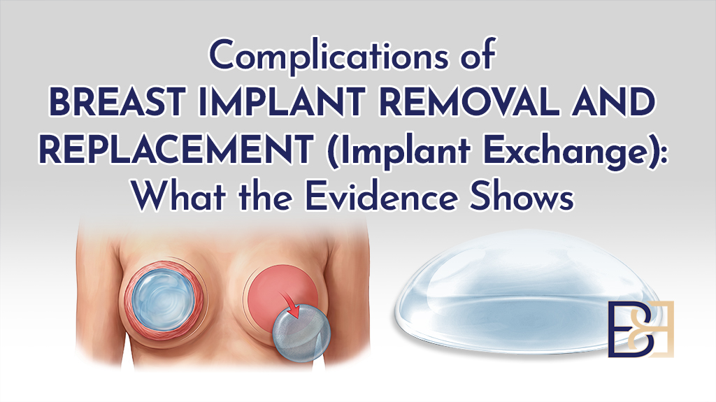 Complications of Breast Implant Removal and Replacement-featured image