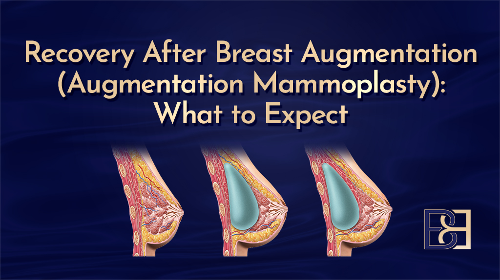 Recovery After Breast Augmentation (Augmentation Mammoplasty)
