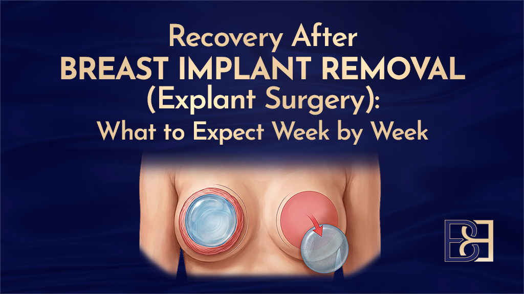 Recovery After Breast Implant Removal (Explant Surgery) Week by Week