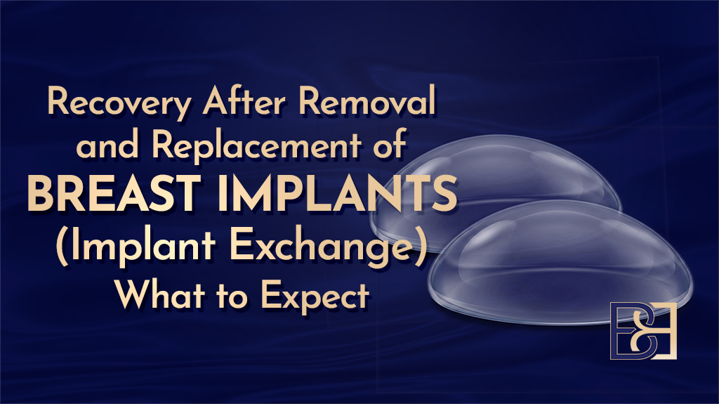 Recovery After Removal and Replacement of Breast Implants (Implant Exchange)