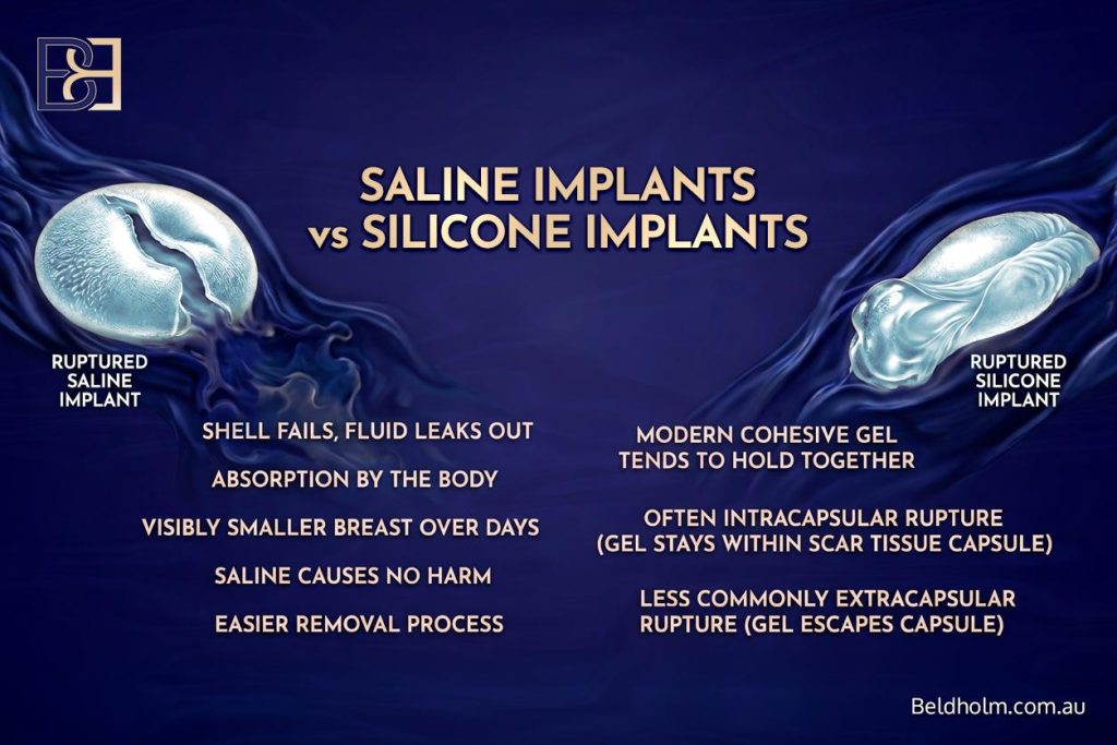 Saline Implants vs Silicone Implants